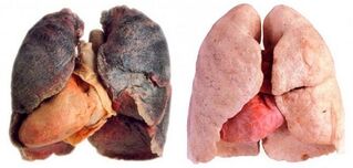 healthy smoker lungs